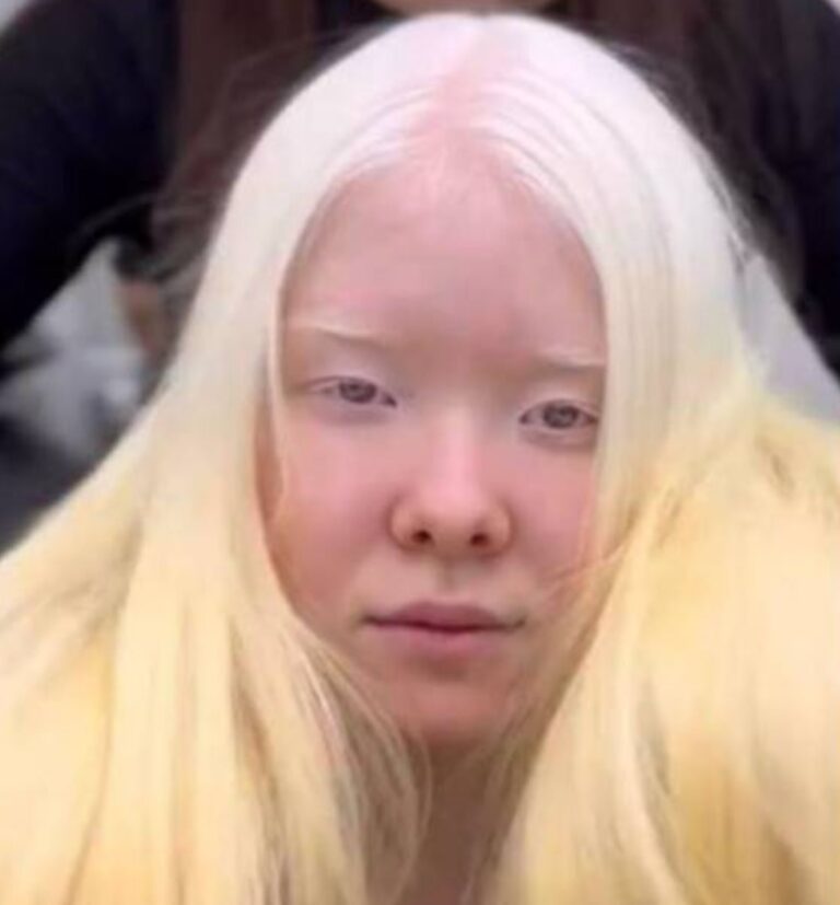 Una sorprendente transformación: ¡una joven con albinismo ha decidido cambiar su look y volverse morena!
