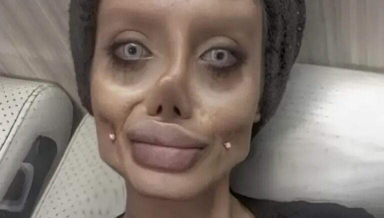 Se sometió a 50 operaciones para parecerse a Angelina Jolie. Descubre cómo era antes.