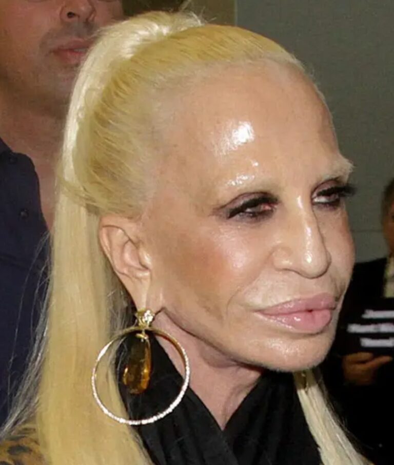 Antes de someterse a sus cirugías, Donatella Versace lucía muy distinta… ¡y deslumbrante!”