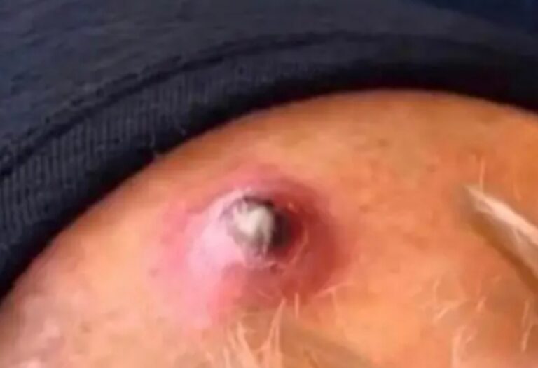 ¡No ignore las señales de alerta de su cuerpo!