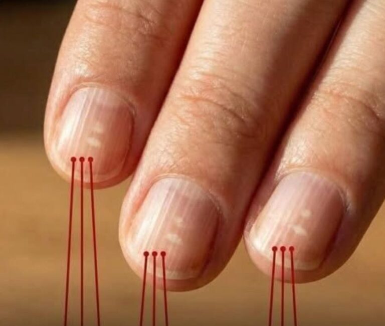 Pourquoi des lignes verticales apparaissent-elles sur vos ongles avec l’âge ?
